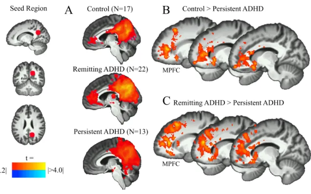 FIGURE 1. (A) One sample t-tests in each group showed positive functional 
