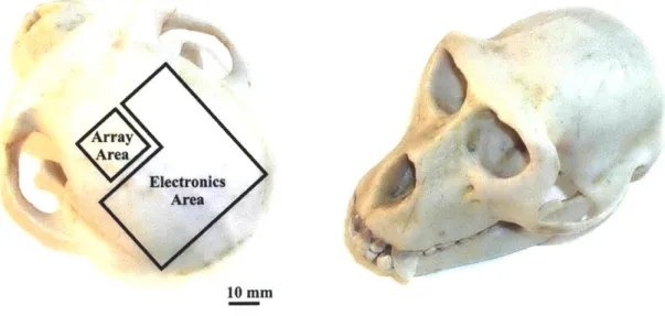 Figure 1-1.  Images  of a  monkey  skull  showing  the approximate areas available  for the telemetric electrode  array system  (TEAS)  [8,11]