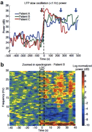 Figure  2.3:  The  slow  oscillation  develops  abruptly  at  loss  of  consciousness  (LOC) and  is  maintained  thereafter