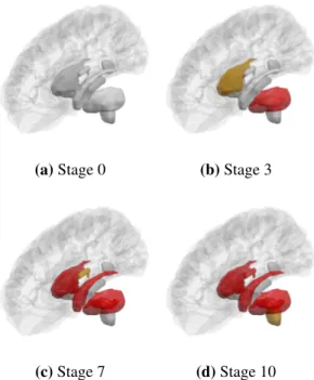 Figure 5: Progression of pathology in subcortical regions within a glass brain, using images generated with our method.