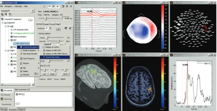 Figure 1: General overview of the Brainstorm interface. Considerable eﬀort was made to make the design intuitive and easy to use