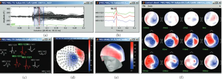 Figure 2: Brainstorm features multiple solutions for the visualization of MEG/EEG recordings.