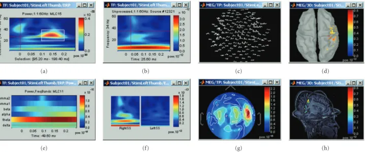 Figure 12: A variety of display options to visualize time-frequency decompositions using Brainstorm (see text for details).