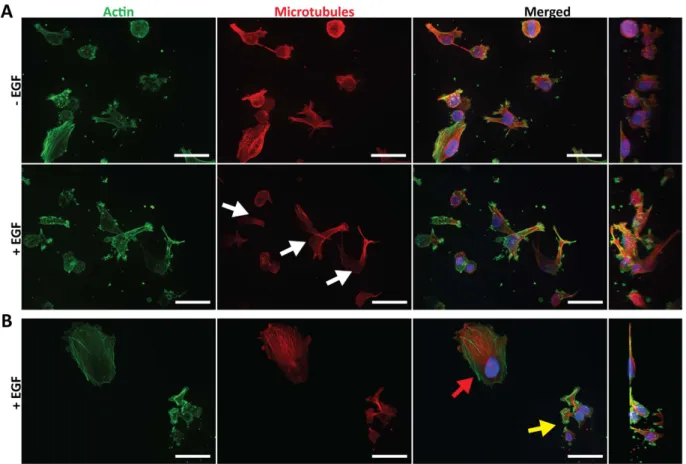 Figure 11. (A) Schematic of tumor cell and CAF interactions within the 3D platform. (B) SUM-159 cells  expressing mCherry (red) invading into the stroma with or without CAFs, scale bar: 100 μ m