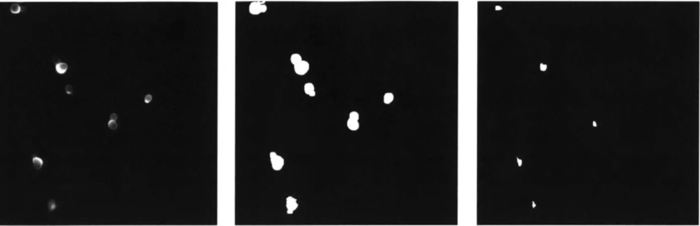 Figure  6:  Comparison  of original  ConA  image  (left)  with its  cell  outlines  after edge  detection (middle)  with  the  final  output  after  smoothing  and  watershedding  (right)