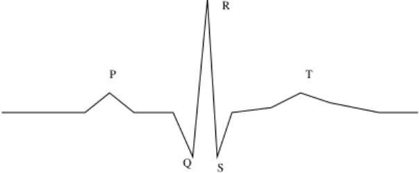 Figure 3. Schema of an ECG pulse with commonly identified reference points (PQRST).