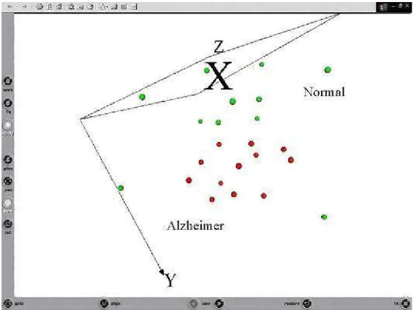 Fig. 8. VR space of the ratio data. Green: Alzheimer; Red: Normal.