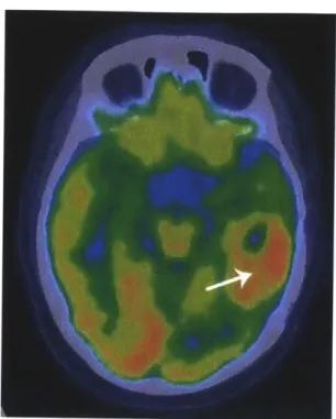 Figure  9 Modality:  positron emission tomography.