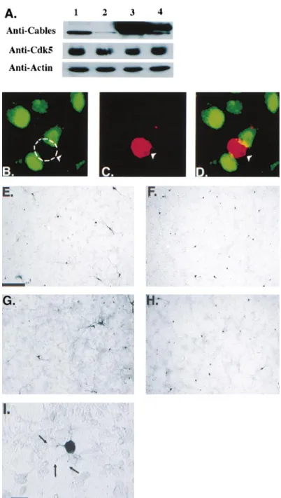 Figure 7. Expression of Antisense Cables in Primary Cortical Neurons Inhibits Neurite Outgrowth