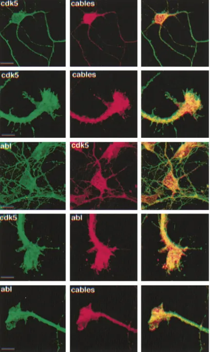 Figure 6. Cdk5, Cables, and c-Abl Colocalize in Primary Cortical Neurons