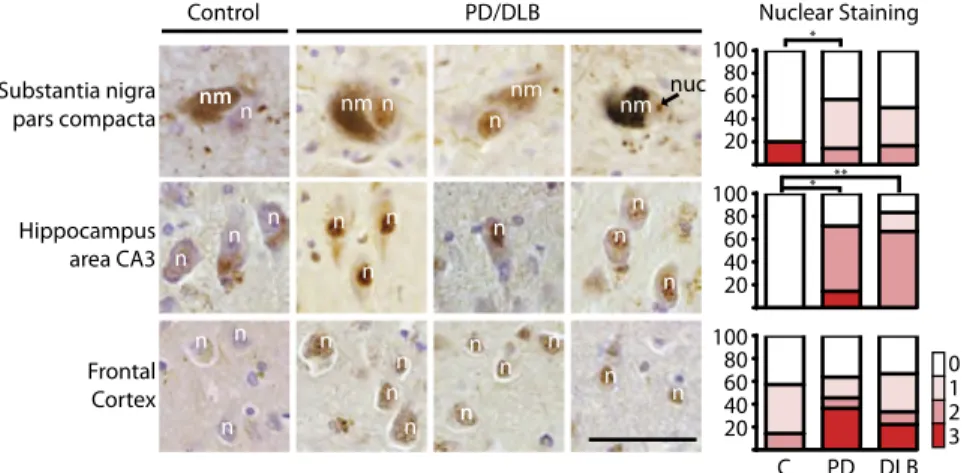 Fig. 6. NFATc4 nuclear expression is increased in cases of PD and DLB. Immunohistochemistry for NFATc4 staining in neurons from the substantia nigra pars compacta, hippocampus area CA3, and layers 5 and 6 of the frontal cortex in human PD and DLB cases