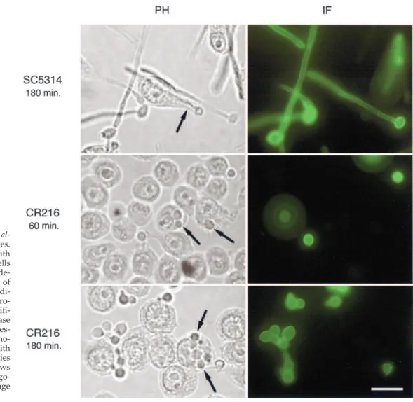 Table 3. Survival of Candida albicans cells cultured with macrophages (cell line RAW264.7)