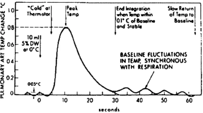 Figure  1-3:  Typical thermodilution  curve.  Baseline  fluctuations  may reach 0.1  degrees Celsius