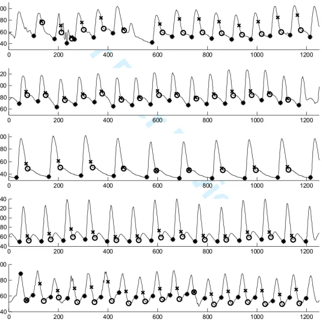 Fig. 1:  Five examples of ABP waveforms and their key features as identified by our  automated algorithms