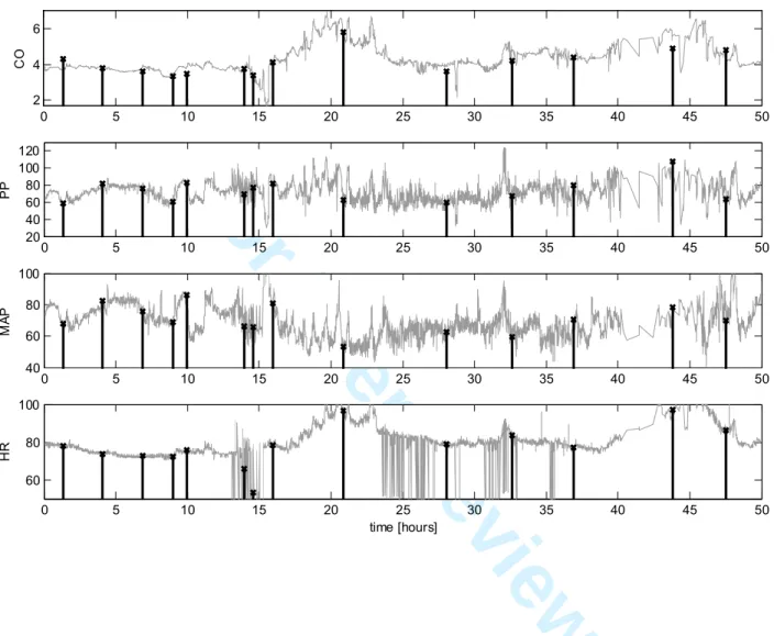 Fig. 4:  Example of continuous CO-from-ABP estimated by the Liljestrand algorithm (grey line) versus  episodic thermodilution CO measurements (stem plots) for a subject over a 50 hour time interval, using a  single calibration (C1, see text for details)