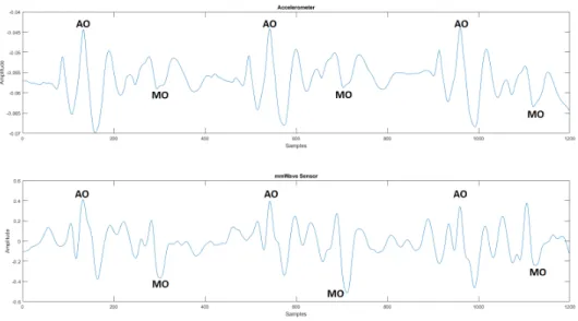 Figure 5-1: The SCG signal recorded using an accelerometer (top) was time-synced with the mmWave recording (bottom) in post processing.