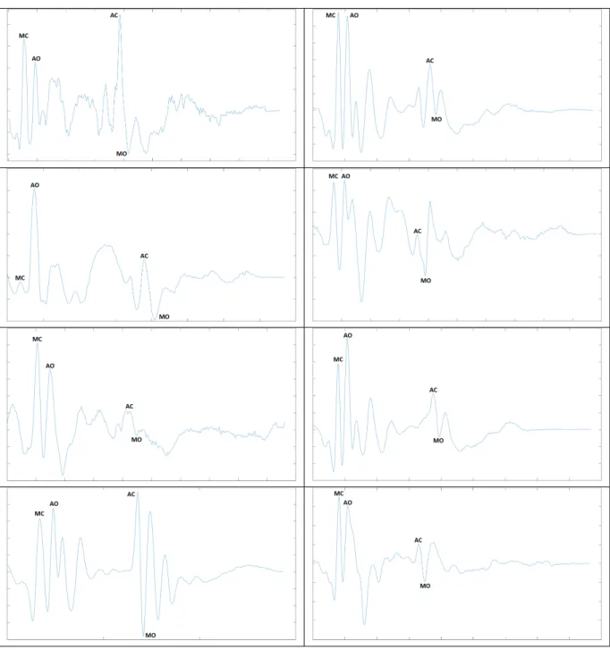 Figure 5-6: The above results are from trials collected from different individuals and averaged in the method discussed above