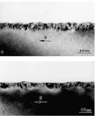 Fig. 5. (1 0 0) plan-view bright field image ðg ¼ 0 4 0Þ of an In 0.5 Ga 0.5 As 0.5 P 0.5 epitaxial layer with 2% tensile strain (a) and a corresponding [1 0 0] diffraction pattern (b)