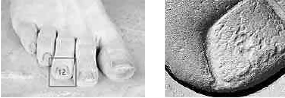 Figure 7.  A scan detail (right image) of the middle toe on the right leg of David.