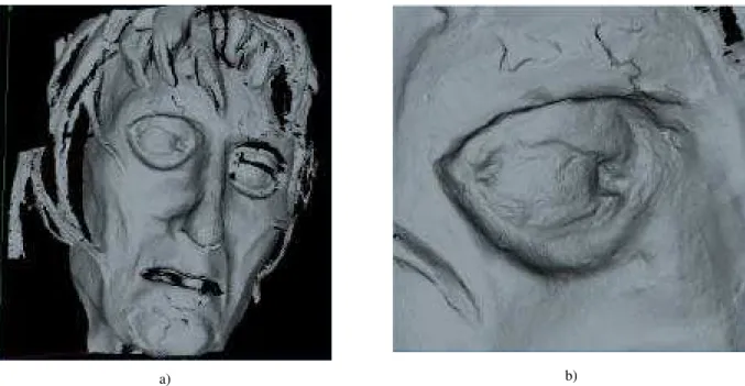 Figure 5 – 3D model of the Maddalena displayed using synthetic shading, a) portion of the face and b) the left eye