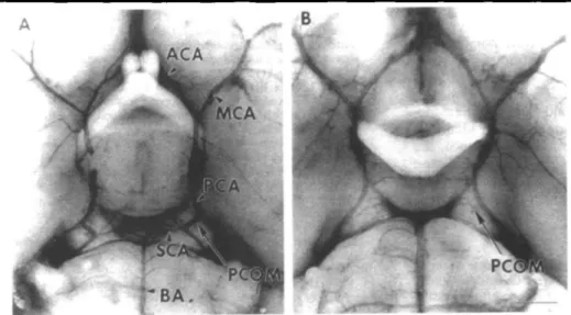 Fig. 2 Photomicrographs of circle of Willis in SV-129 (A) and C57black/6 (B) mice, showing marked difference in posterior communicating arteries after carbon black ink perfusion.