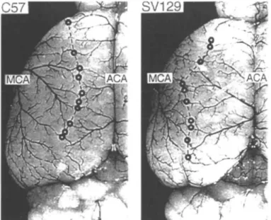 Fig. 3 Dorsal view of the cerebral hemisphere of C57black/6 mice (left) and SV-129 mice (right) after microvascular injection with carbon black stained latex