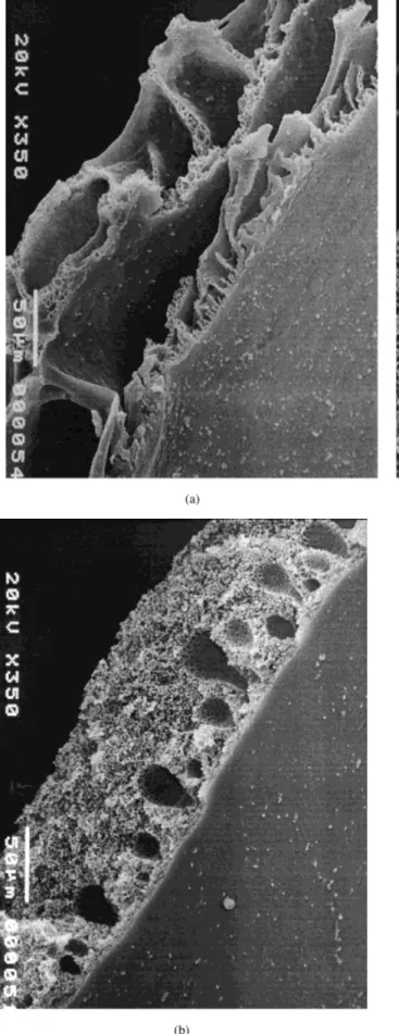 Figure 2 SEM pictures of membranes prepared from different polymer concentrations: (a) 10 wt %, (b) 20 wt