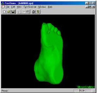 Figure 1: ShapeGrabber FootScanner System. Figure 2: 3-D model created from multiple view registered range images.