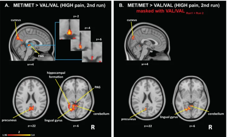 Table 2. Brain structures exhibiting a significant genotype effect for HIGH pain in the second run.