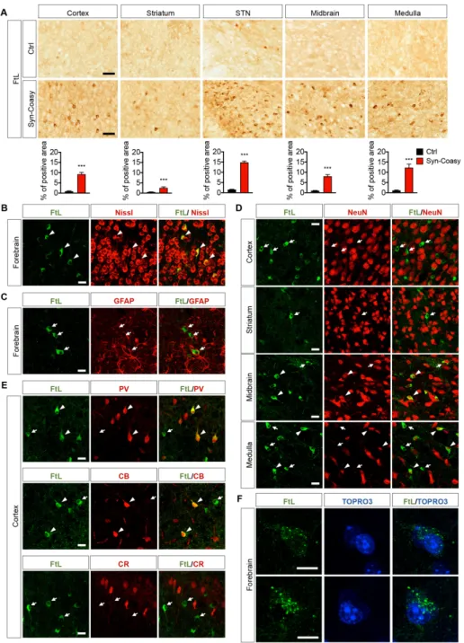 Figure 5. L-chain ferritin accumulation in sections of the Syn-Coasy mouse brain. (A)  Immunohistochemical analysis of brains of 12–14-day-old animals showing FtL-positive cells  accumulation in the cortex, striatum, subthalamic nucleus (STN), midbrain, an
