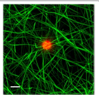 Fig. 4 Fibrin network formed with fluorescent microspheres. A field with only one bead was magnified in order to appreciate that these particles did not interact with fibers
