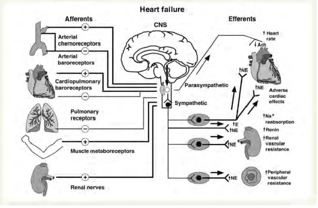 Figure  2:  Synthèse  des  mécanismes  d’activation  du  système  nerveux  sympathique  dans  l’insuffisance  cardiaque  chronique [10]