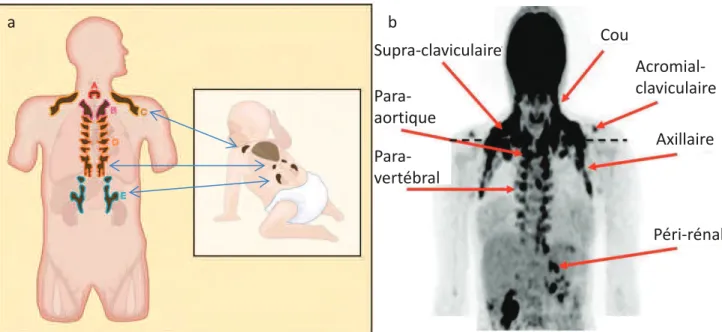 Figure 9 : Localisations du tissu adipeux brun chez l!homme 