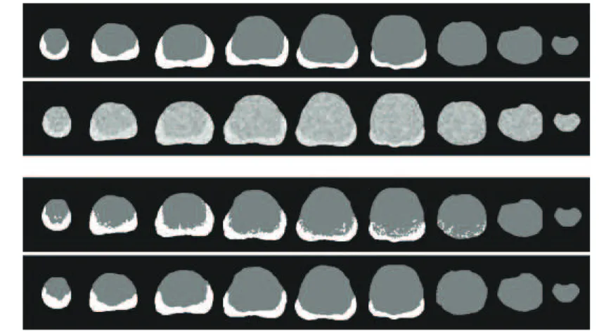 Figure 6: Illustration of the impact of introducing contextual information and morphological feature: segmentation results from ECM and MECM (third and fourth rows from the top, respectively) are viewed in axial slices, from prostate’s apex (left) to the b