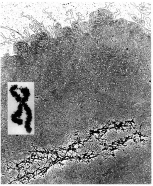 Figure 10 : échafaudage protéique des chromosomes (d’après Paulson et al., 1977).