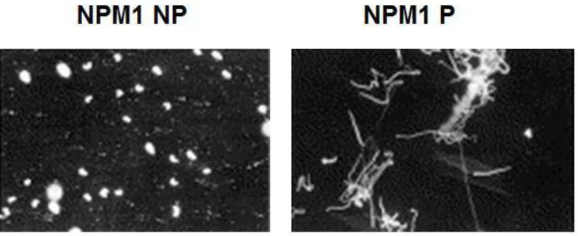 Figure 11 : Impact de NPM1 dans la condensation de la chromatine. En présence de NPM1 non  phosphorylée (inactive) la chromatine de sperme est condensée