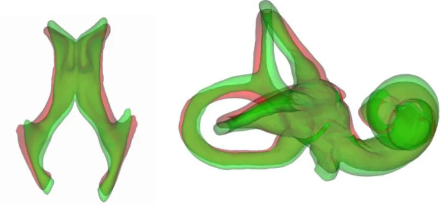 Figure 7: Examples of pairs of ground truth data: Left: lateral ventricles.