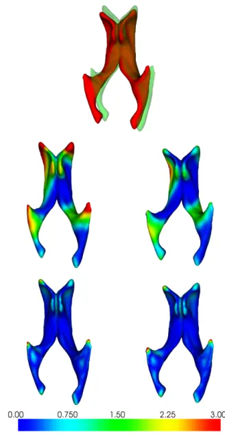 Figure 10: Effect of the symmetrisation: From left to right and top to bottom: i) two misaligned pairs of lateral ventricles A and B viewed from below;