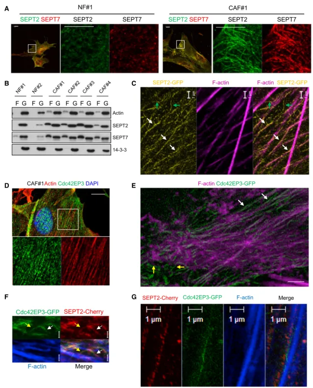 Figure 2. CAFs Have Enhanced Actin and Septin Cytoskeletal Networks