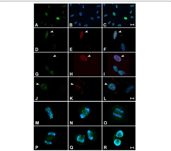 Figure 2 Biphasic P-Ser 83 -HP1γ is observed during cell cycle progression. (A,B,C) P-Ser 83 -HP1γ levels vary during the cell cycle