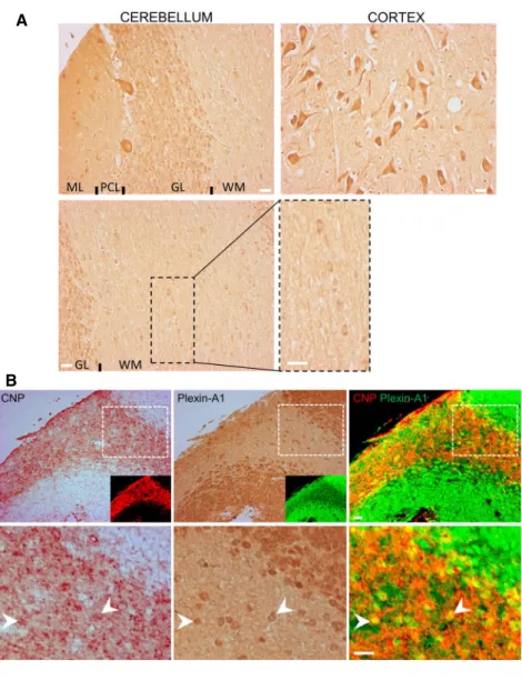 Figure 1. Expression of Plexin-A1 in the human brain.