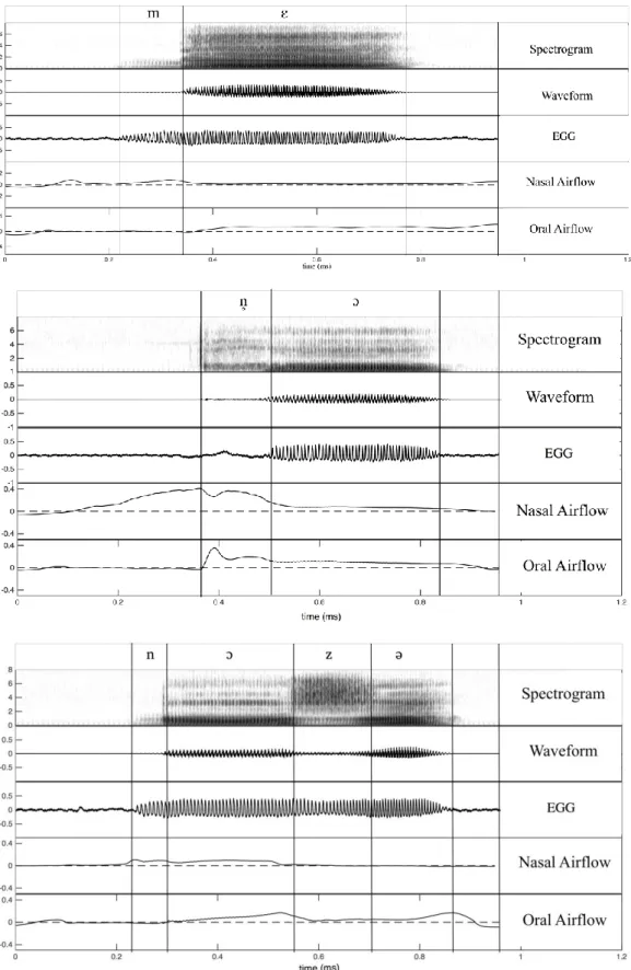 Figure  7:  Spectrograms,  waveforms,  and  electroglottographic  (EGG)  signals,  nasal  airflow,  oral airflow for the Xumi words /  ɛ⁵⁵/ ‘medicine’ (top panel), /mɛ⁵⁵/ ‘bamboo’ (second from  top), /  ɔ ⁵/ ‘animal hair, fur’ (third from top), and /nɔ³³zə