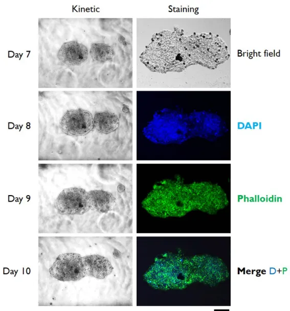 Figure 3.  Typical bright field and epifluorescence microphotographs of HT29 cells cultured in  gelatin-coated microchannels (left column) or in control uncoated microchannels (right column)