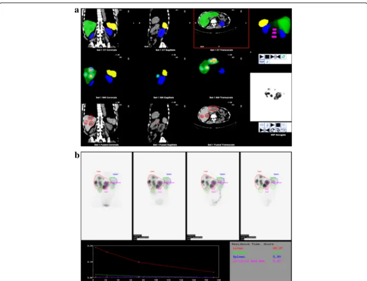 Fig. 3 Dosimetry toolkit® workflow. a Example of segmentation of the organs at risk performed manually using the Dosimetry Toolkit® tools using SPECT or CT data