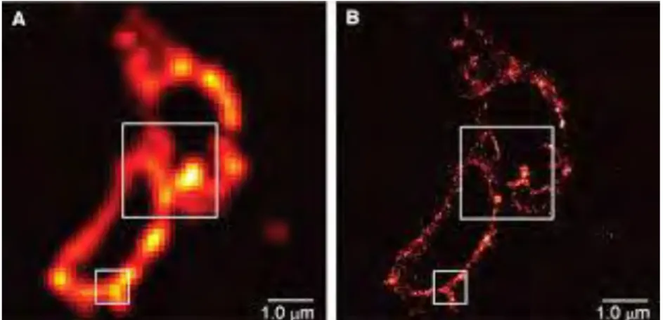 Figure 9:Comparaison d'une même cellule COS-7 exprimant la protéine lysosomale 