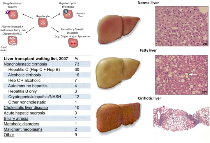 Figure 2. The Liver in Health and Disease