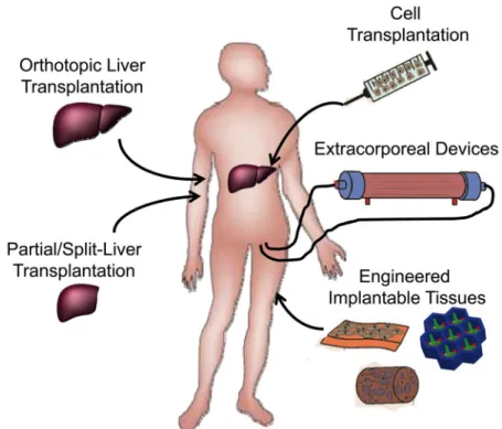 Figure 3. Organ transplantation and cell-based therapies