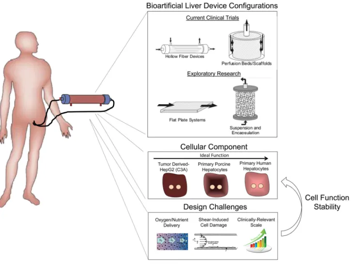 Figure 4. Extracorporeal bioartificial liver devices