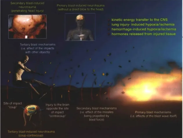 Figure  2-2:  Schematic  of  the  primary,  secondary,  and  tertiary  blast  mechanisms  and  the characteristic  brain  injuries