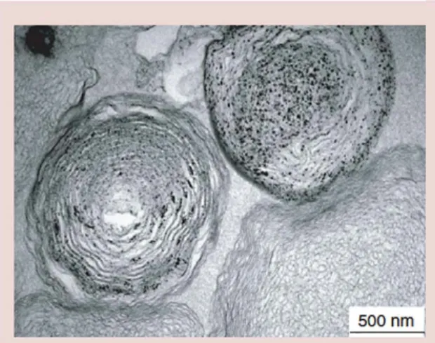 Figure 1. Transmission electron microscopy image of  multilamellar lipsomes containing nano hydroxyapatite  particles and minerais in a calcifying buffer (scale  500 nm)